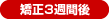 矯正3週間後